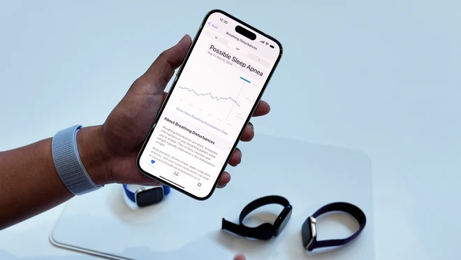 7 Lý Do Nên Sở Hữu Apple Watch Phát Hiện Ngưng Thở Khi Ngủ – Chính Hãng Gold Store 4 So sánh Apple Watch phát hiện ngưng thở khi ngủ với thiết bị y tế truyền thống về khả năng theo dõi hô hấp ban đêm